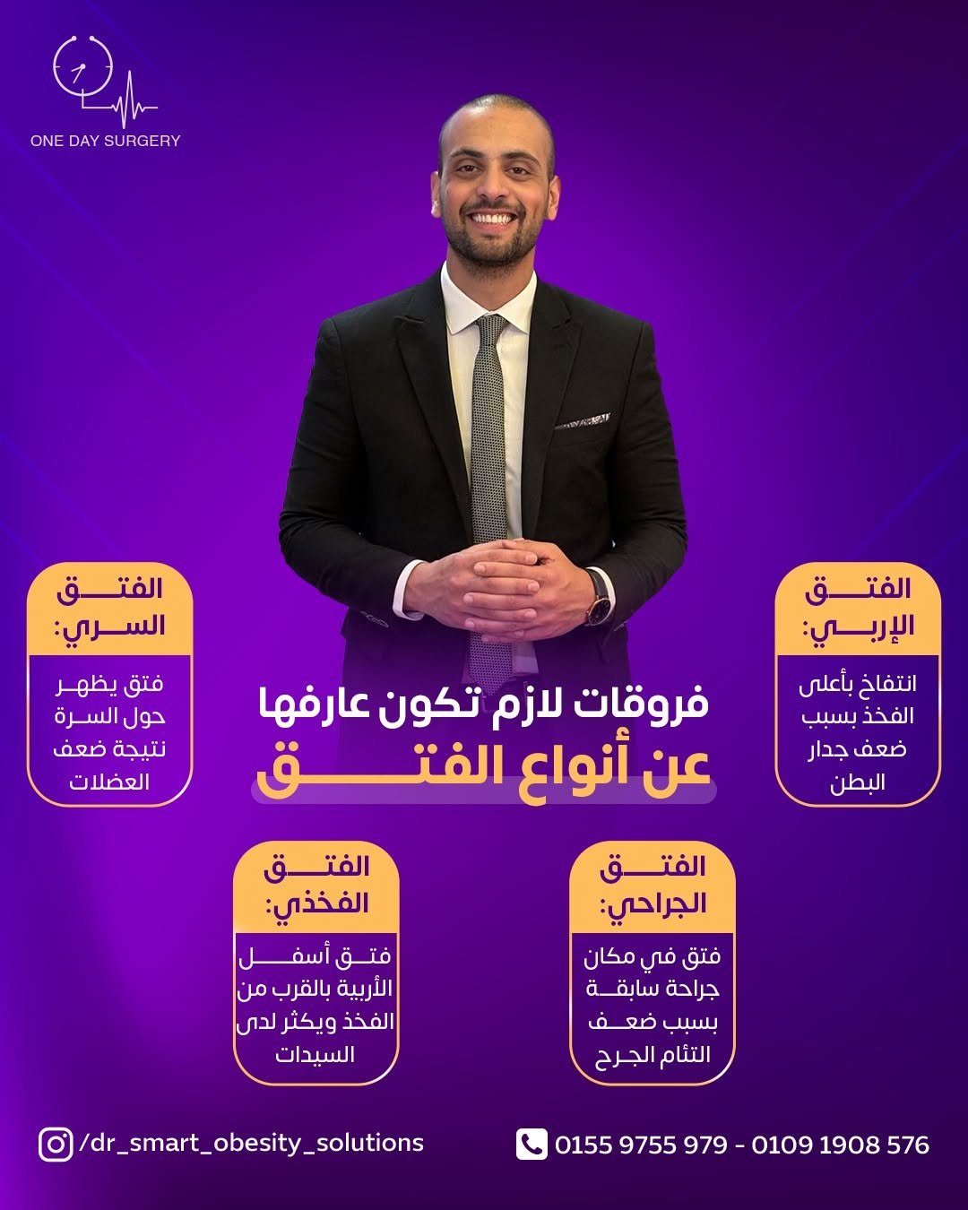 انواع الفتق اربعة الاربي السرى الجراخي الفخذى