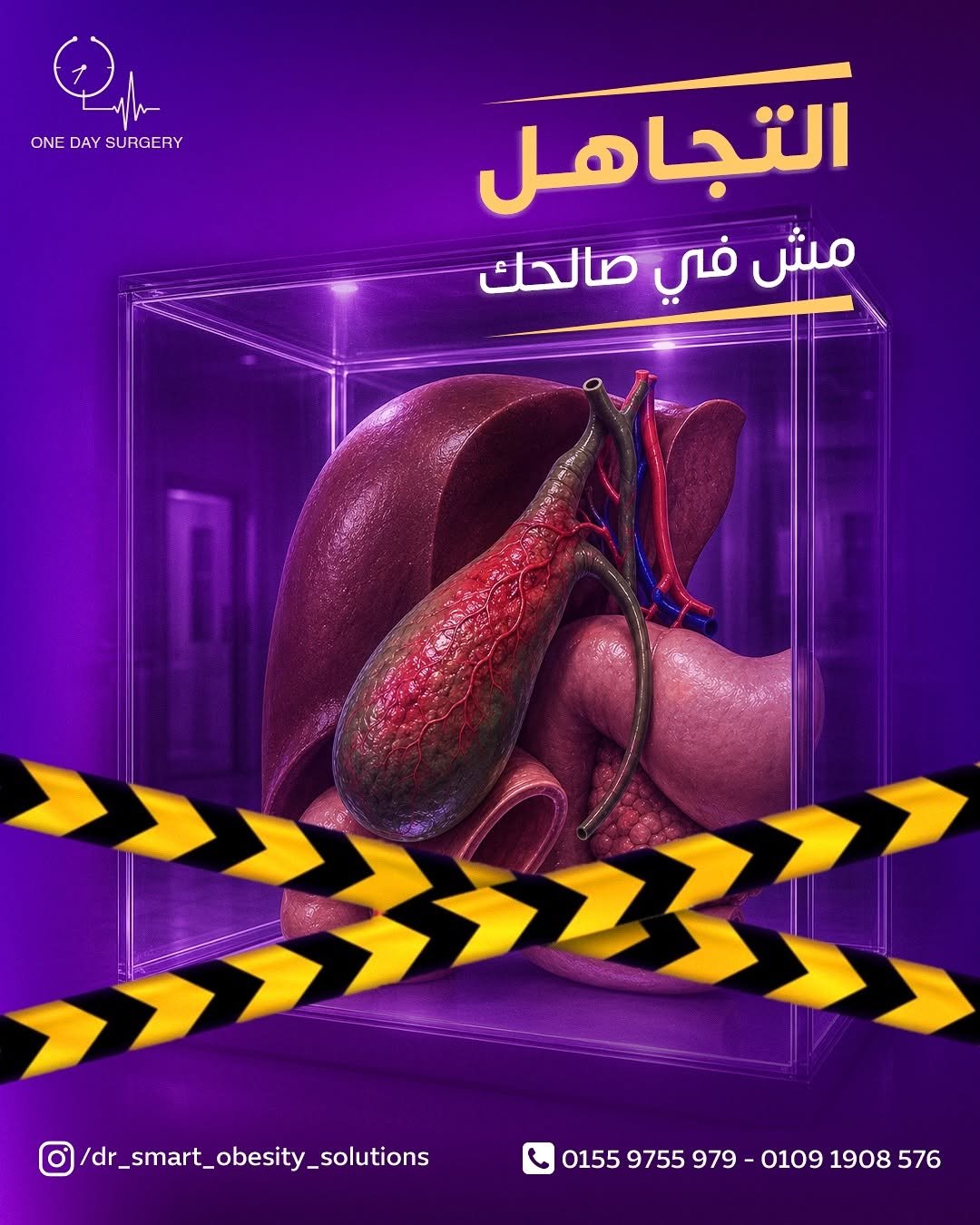 تجاهل ألم المرارة ممكن يسبب مشاكل أكبر مع الوقت